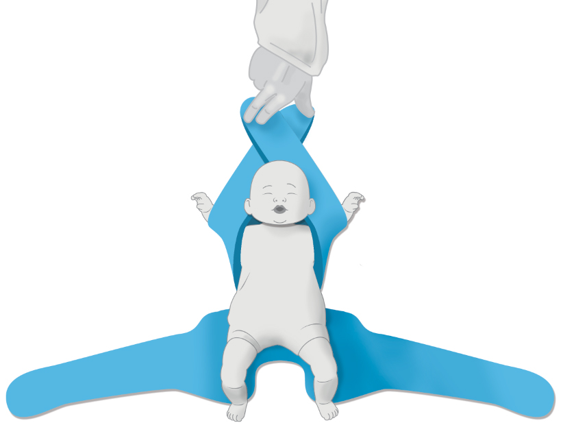A Two Arm Hold - Pediatric Position Holder & Immobilizer