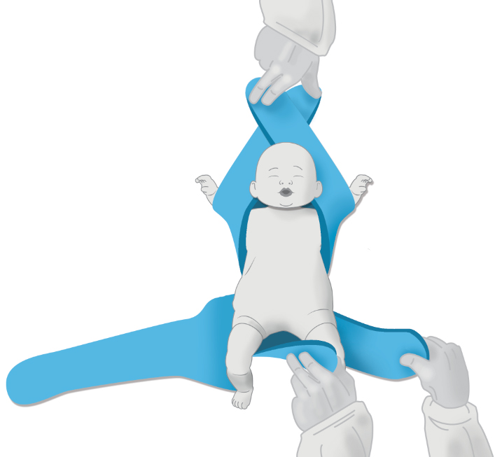 Two Arm Immobilization - Pediatric Position Holder & Immobilizer